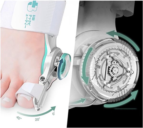 Toe Straightener Corrector